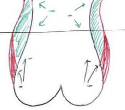 腰の脂肪吸引・雅美容外科川端院長によるイラスト