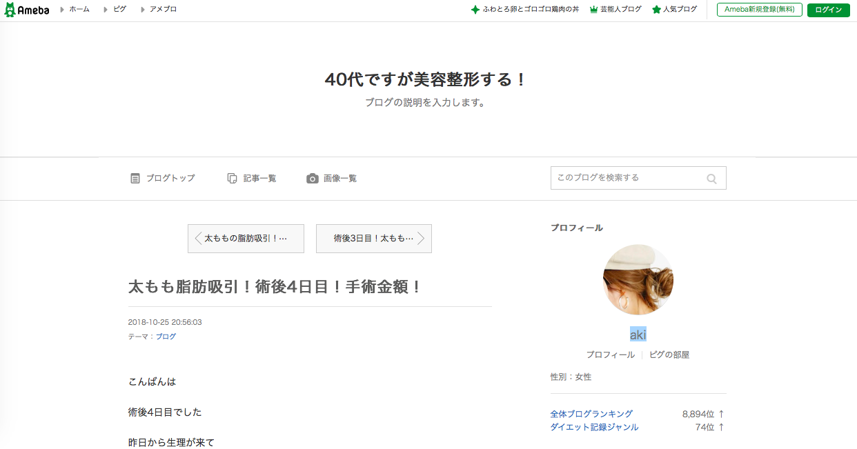 40代ですが美容整形する！のキャプチャ