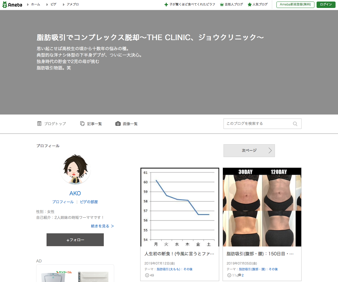 脂肪吸引でコンプレックス脱却のキャプチャ