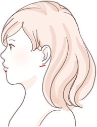 顔の脂肪吸引での傷の位置